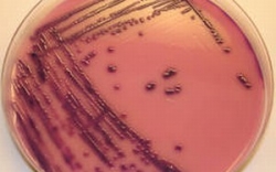 Bacteria ucigasa E. Coli, in Romania pe usa din dos: Vezi produsele suspecte